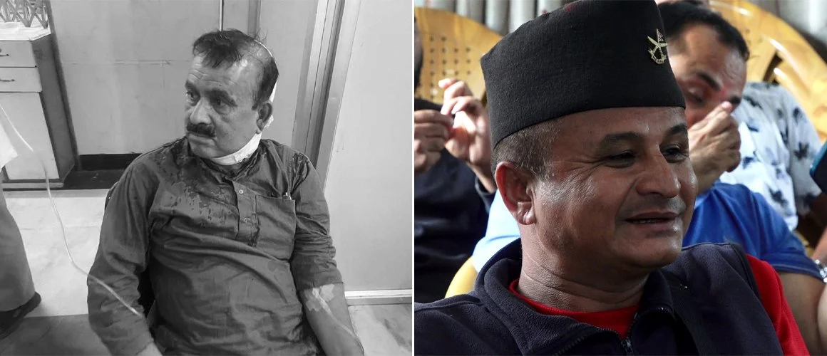 कांग्रेसले भन्यो–सहमहामन्त्री यादवलाई आक्रमण गर्नेमाथि कडा कारबाही होस्