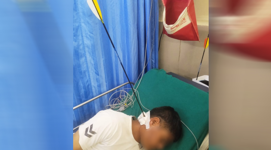 बोर्डमा हानेको तीर मान्छेको टाउकोमा लागेपछि...